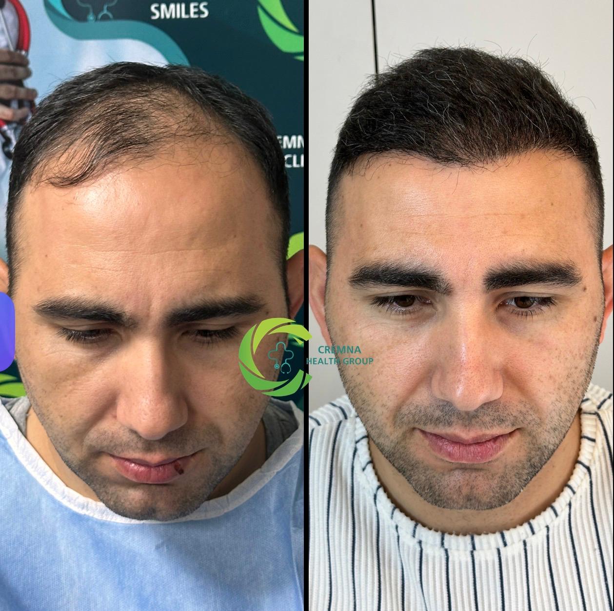 Patient result 2