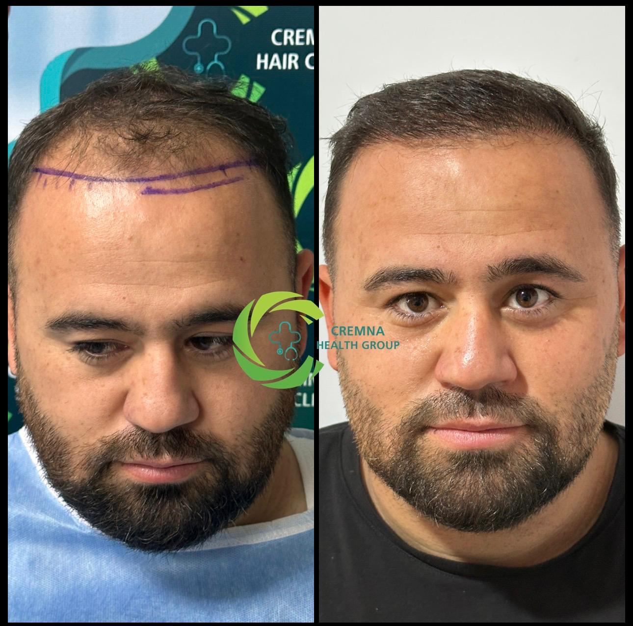 Patient result 3