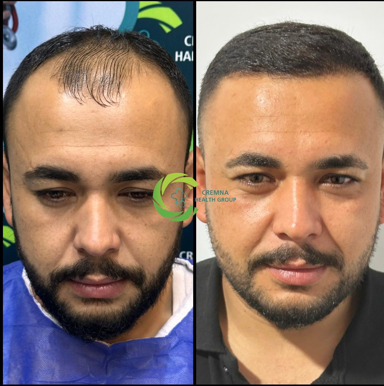 Patient result 6