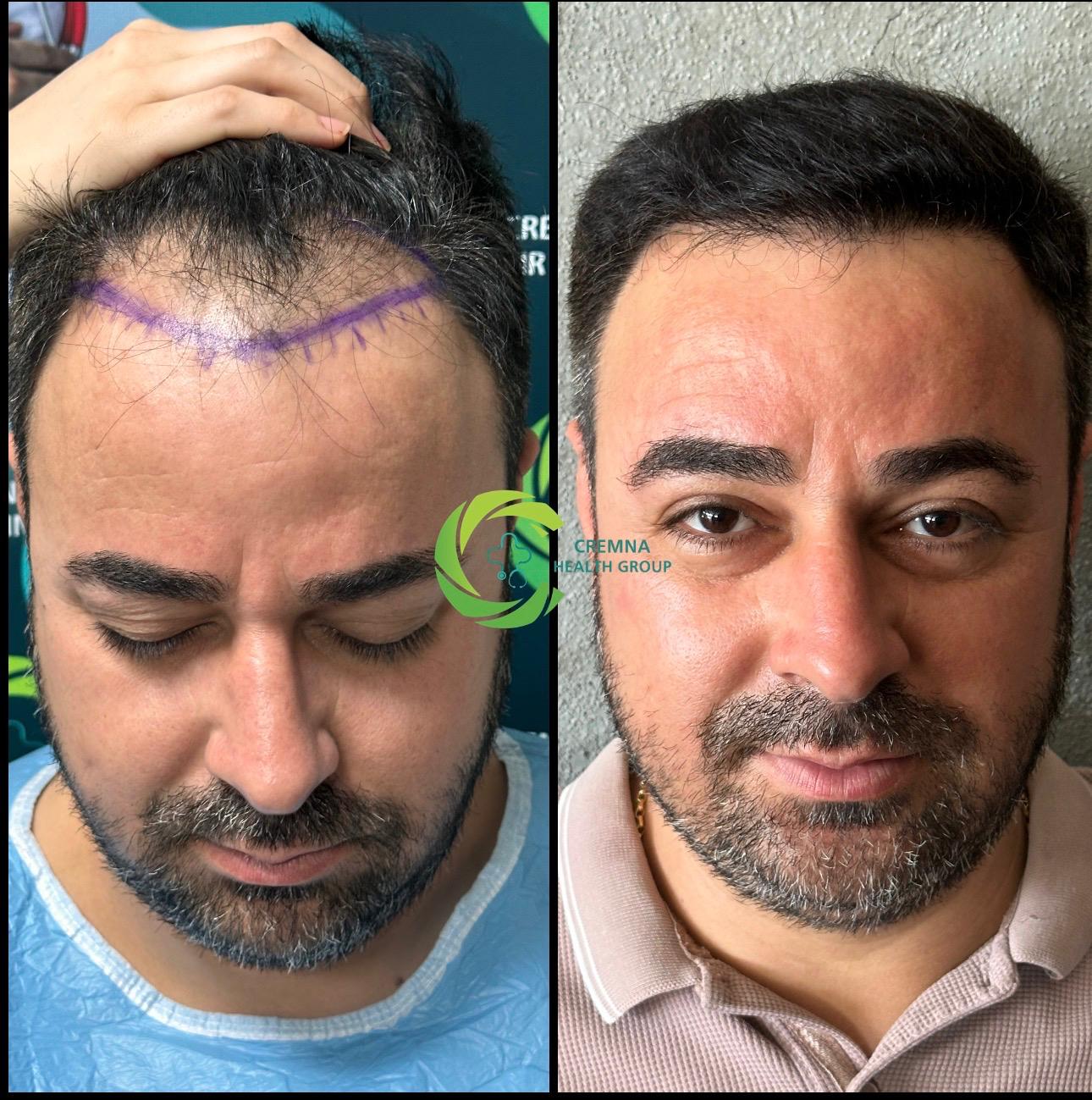 Patient result 7