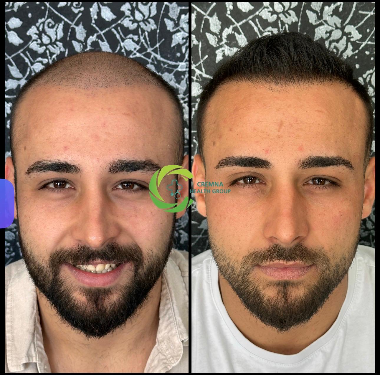 Patient result 8