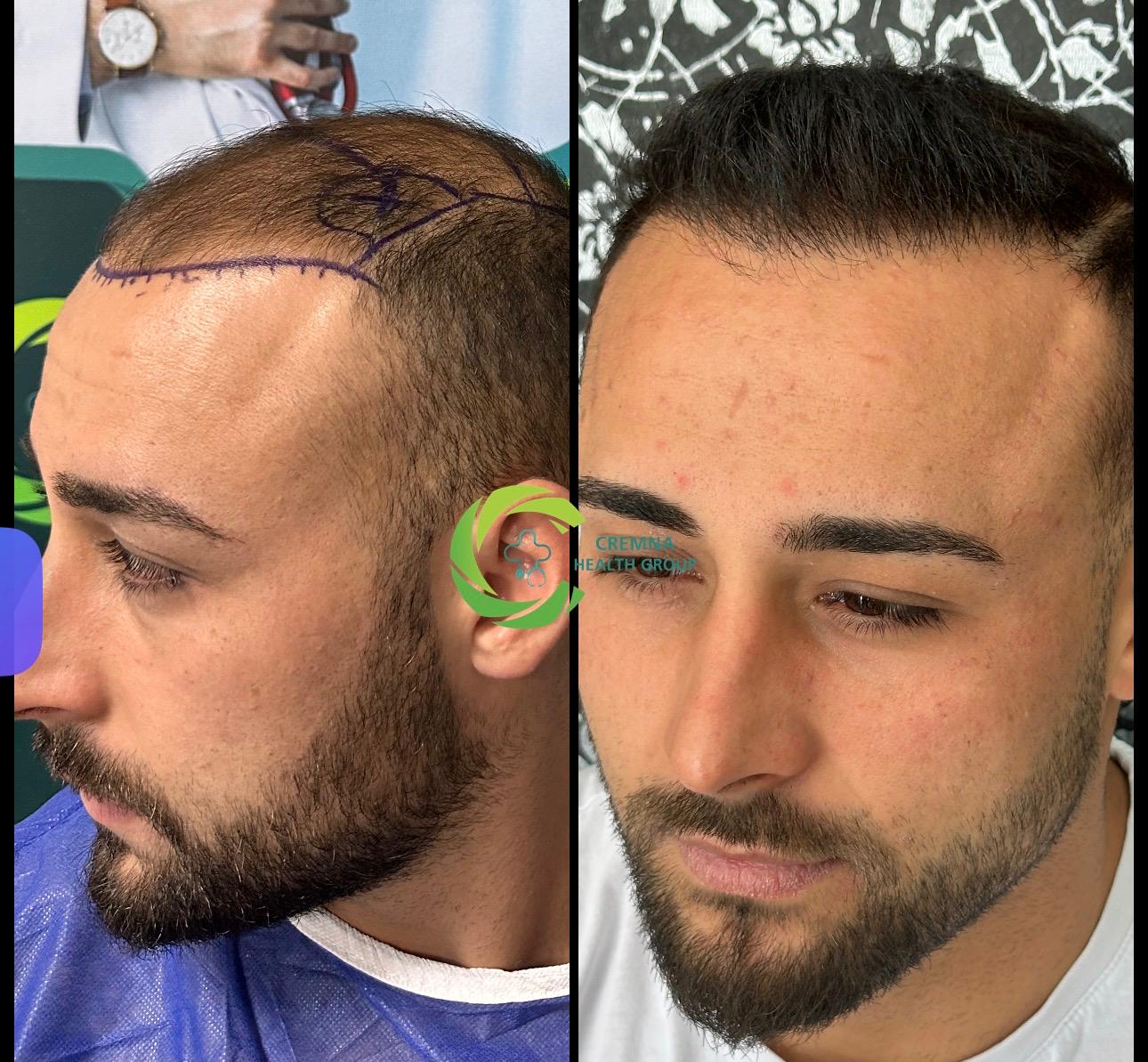 Patient result 9