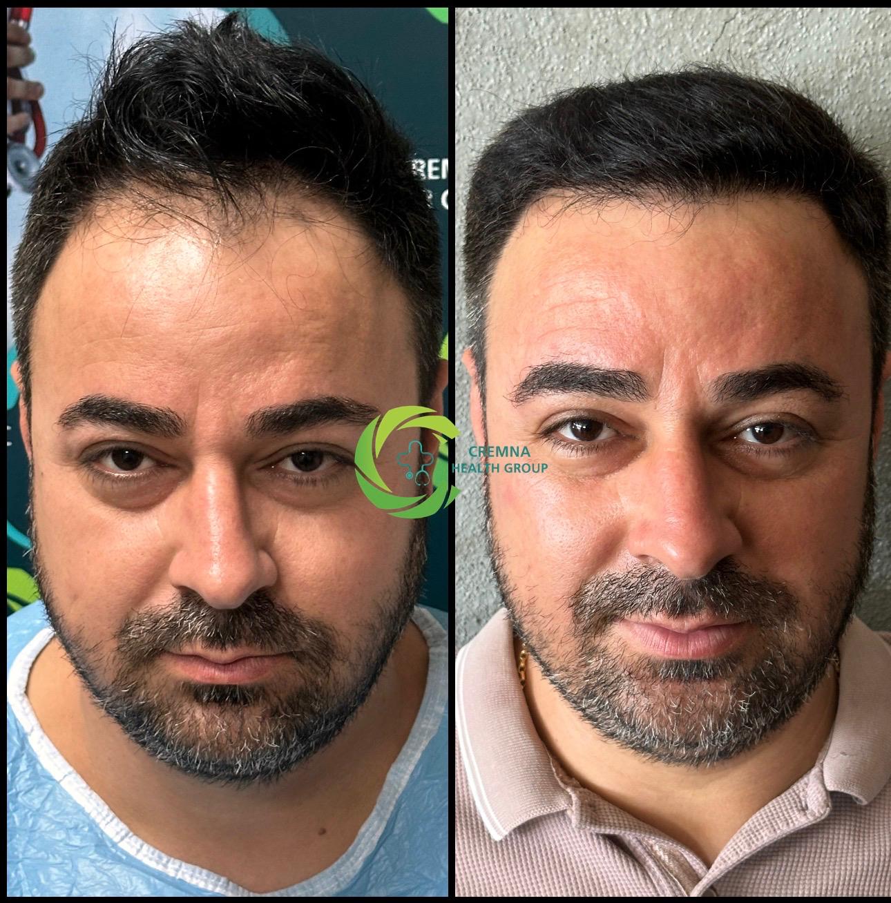 Patient result 4